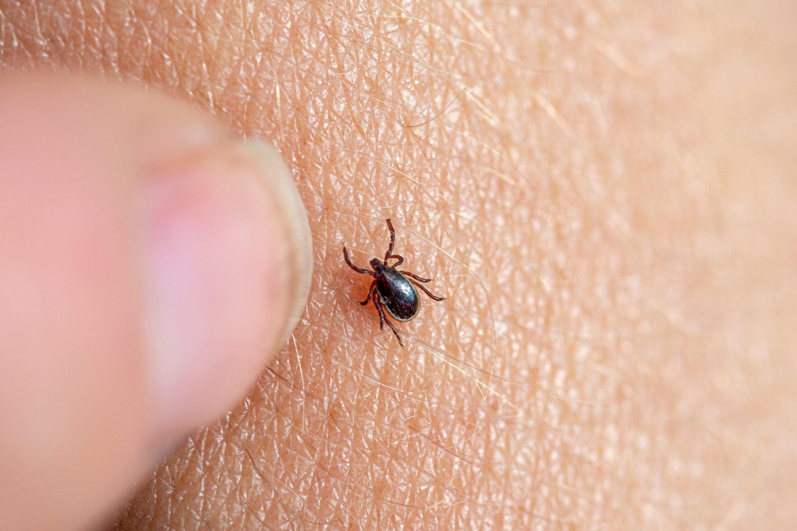 Tick Pest Control That Really Works Get Started | Bug Squashers of Maryland